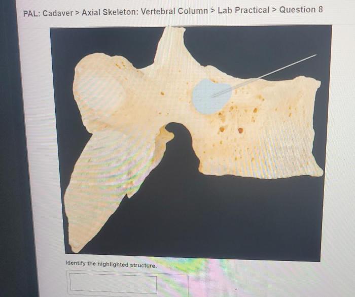 Pal cadaver axial skeleton skull lab practical question 1