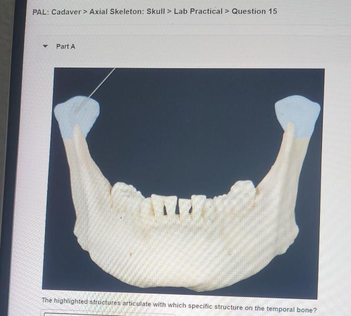 Pal cadaver axial skeleton skull lab practical question 1