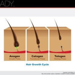 Properties of the hair and scalp chapter 11