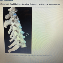 Pal cadaver axial skeleton skull lab practical question 1