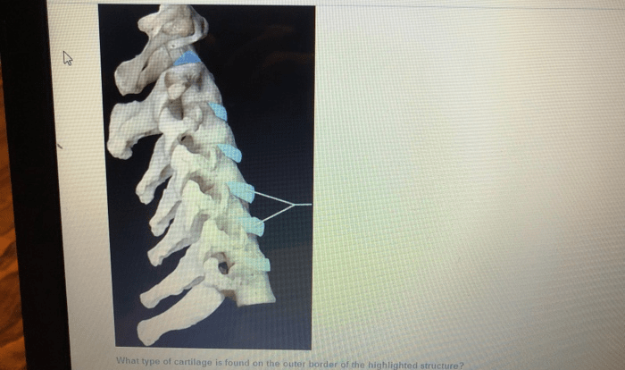 Pal cadaver axial skeleton skull lab practical question 1