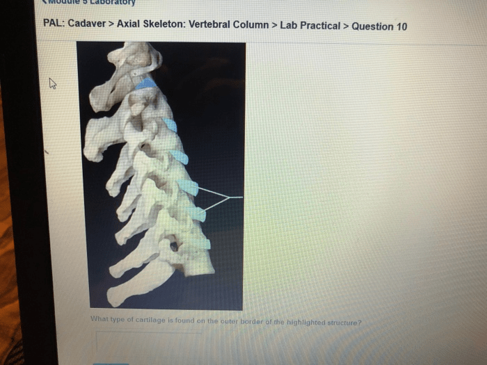 Pal cadaver axial skeleton skull lab practical question 1